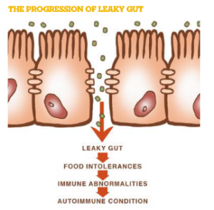 Leaky Gut Progression